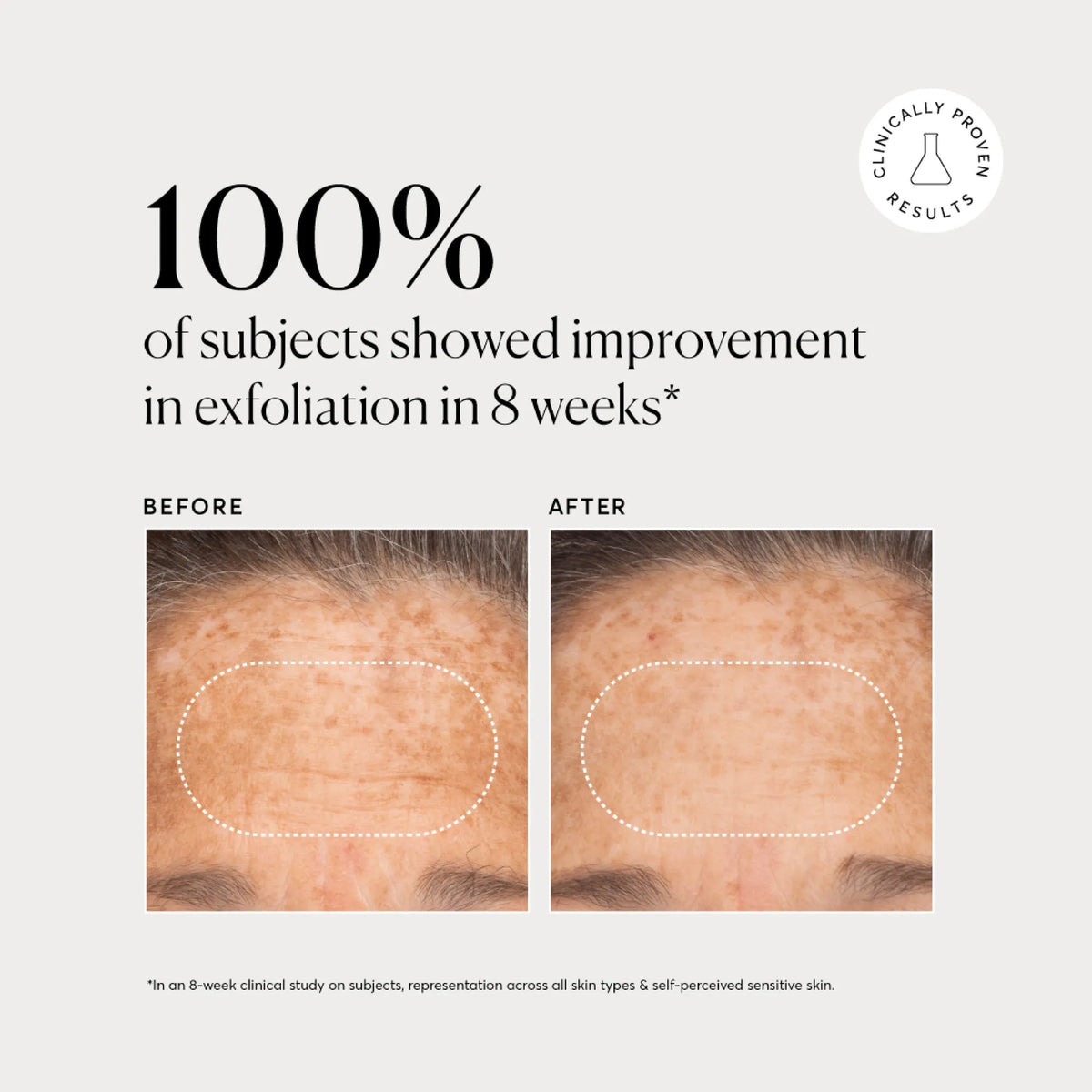 bha-liquid-exfoliant-2-w7 NATR-10027-Alt-Images-BHA-Liquid-Exfoliant-2_-03.webp