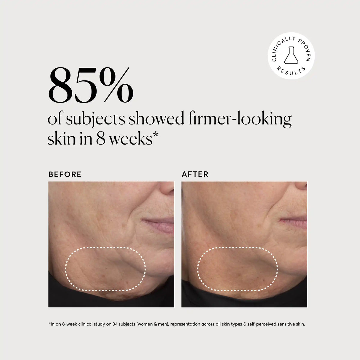 retinol-complex-serum-o1 NATR-10034-Alt-Images-Retinol-Complex-Serum-04.webp